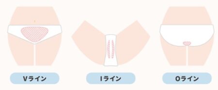 オーパスビューティ―03 power pro 利用可能部位　vio　図解